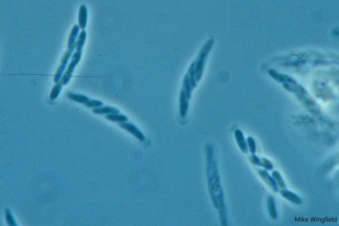 Asci and ascospores of Chr. austroafricana .